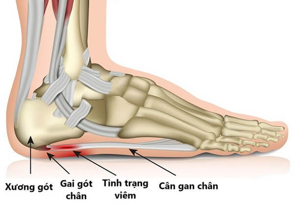 cau-tao-can-gan-ban-chan