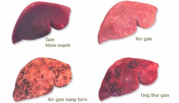 cong-dung-nuoc-gung-mat-ong-cho-nguoi-chay-bo-20