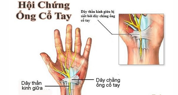 hoi-chung-ong-co-tay-2