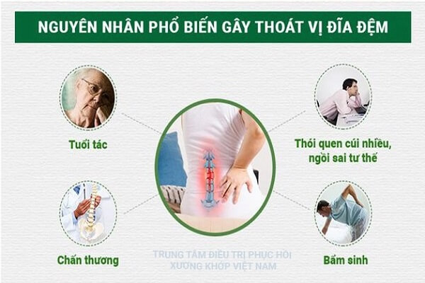 nguyen-nhan-gay-thoat-vi-dia-dem-2