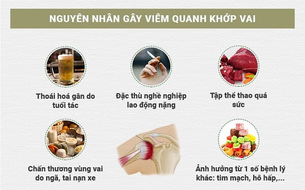 nguyen-nhan-viem-quanh-khop-vai